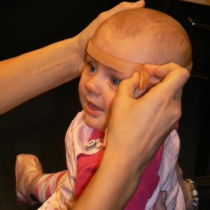 plagiocephalometrie-CT-01_De-Kinderpraktijk-Meppel