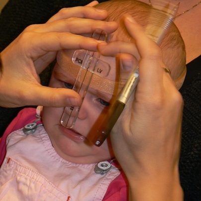 plagiocephalometrie-CT-02_De-Kinderpraktijk-Meppel