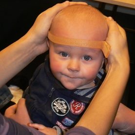 plagiocephalometrie-CT-03_De-Kinderpraktijk-Meppel