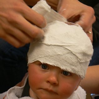 plagiocephalometrie-CT-04_De-Kinderpraktijk-Meppel