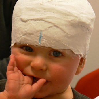 plagiocephalometrie-CT-05_De-Kinderpraktijk-Meppel